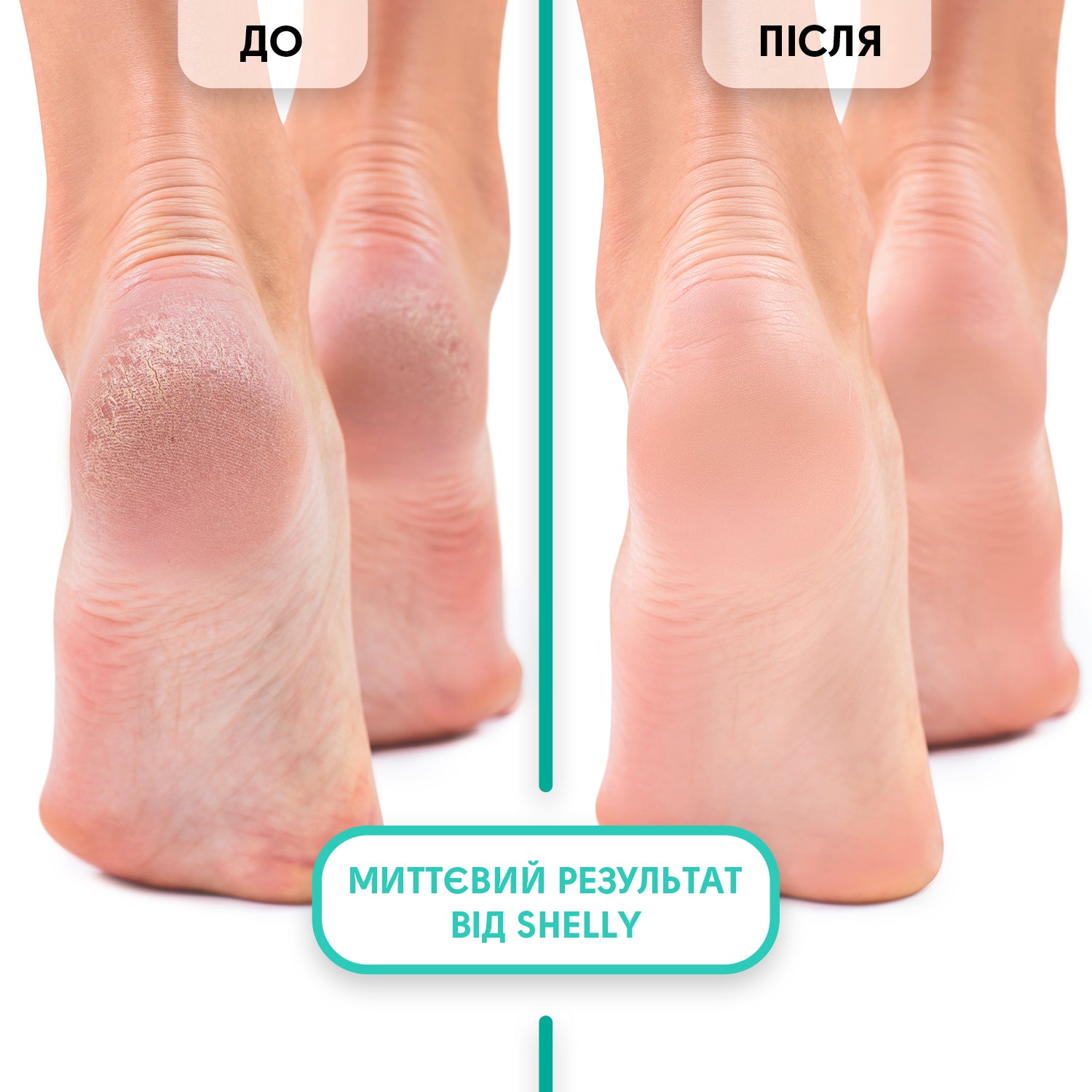 Foam express softener for pedicure Soft blade - 150 ml